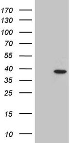 C12orf32 Antibody in Western Blot (WB)