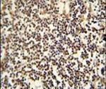 PARPBP Antibody in Immunohistochemistry (IHC)