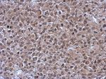 C14orf140 Antibody in Immunohistochemistry (IHC)