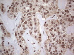 C14orf166 Antibody in Immunohistochemistry (Paraffin) (IHC (P))
