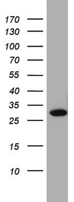 RTRAF Antibody in Western Blot (WB)