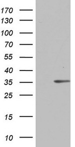 C14orf166 Antibody in Western Blot (WB)