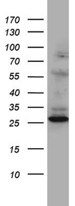 C14orf166 Antibody in Western Blot (WB)