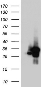 RTRAF Antibody in Western Blot (WB)