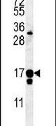 C14orf179 Antibody in Western Blot (WB)