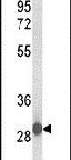 C15orf29 Antibody in Western Blot (WB)