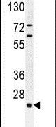 C15orf41 Antibody in Western Blot (WB)