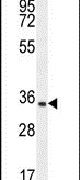 C15orf41 Antibody in Western Blot (WB)