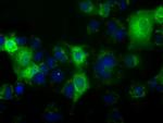 C17orf28 Antibody in Immunocytochemistry (ICC/IF)