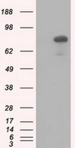 C17orf28 Antibody in Western Blot (WB)