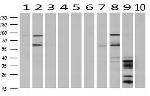 C17orf28 Antibody in Western Blot (WB)