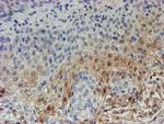 C17orf37 Antibody in Immunohistochemistry (Paraffin) (IHC (P))