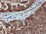 C17orf37 Antibody in Immunohistochemistry (Paraffin) (IHC (P))