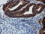 C17orf37 Antibody in Immunohistochemistry (Paraffin) (IHC (P))
