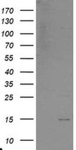 C17orf37 Antibody in Western Blot (WB)