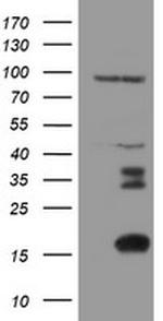 C17orf37 Antibody in Western Blot (WB)