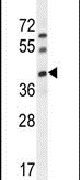 C17orf59 Antibody in Western Blot (WB)