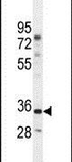 C17orf59 Antibody in Western Blot (WB)