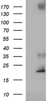 C17orf62 Antibody in Western Blot (WB)