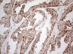 C19ORF80 Antibody in Immunohistochemistry (Paraffin) (IHC (P))