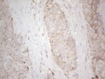 C19ORF80 Antibody in Immunohistochemistry (Paraffin) (IHC (P))
