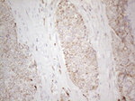 C19ORF80 Antibody in Immunohistochemistry (Paraffin) (IHC (P))