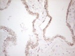 C19ORF80 Antibody in Immunohistochemistry (Paraffin) (IHC (P))