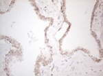 C19ORF80 Antibody in Immunohistochemistry (Paraffin) (IHC (P))