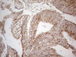 C19ORF80 Antibody in Immunohistochemistry (Paraffin) (IHC (P))