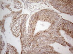 C19ORF80 Antibody in Immunohistochemistry (Paraffin) (IHC (P))