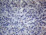 C19ORF80 Antibody in Immunohistochemistry (Paraffin) (IHC (P))