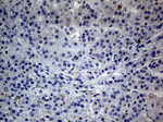 C19ORF80 Antibody in Immunohistochemistry (Paraffin) (IHC (P))