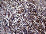 C19ORF80 Antibody in Immunohistochemistry (Paraffin) (IHC (P))