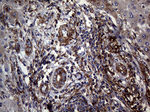 C19ORF80 Antibody in Immunohistochemistry (Paraffin) (IHC (P))