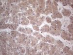 C19ORF80 Antibody in Immunohistochemistry (Paraffin) (IHC (P))