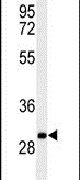 C19orf18 Antibody in Western Blot (WB)