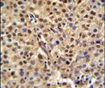 C19orf21 Antibody in Immunohistochemistry (IHC)