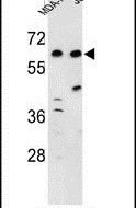 C19orf26 Antibody in Western Blot (WB)