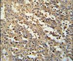 C19orf39 Antibody in Immunohistochemistry (IHC)