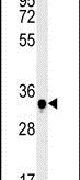C19orf39 Antibody in Western Blot (WB)