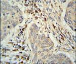 KXD1 Antibody in Immunohistochemistry (IHC)