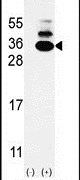 KXD1 Antibody in Western Blot (WB)