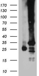 C19orf52 Antibody in Western Blot (WB)