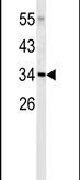 CTRP1 Antibody in Western Blot (WB)
