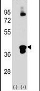 CTRP1 Antibody in Western Blot (WB)