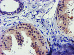 C1S Antibody in Immunohistochemistry (Paraffin) (IHC (P))