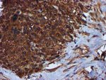 C1S Antibody in Immunohistochemistry (Paraffin) (IHC (P))