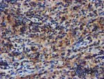 C1S Antibody in Immunohistochemistry (Paraffin) (IHC (P))