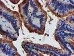 C1S Antibody in Immunohistochemistry (Paraffin) (IHC (P))