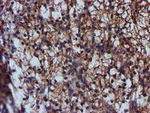 C1S Antibody in Immunohistochemistry (Paraffin) (IHC (P))